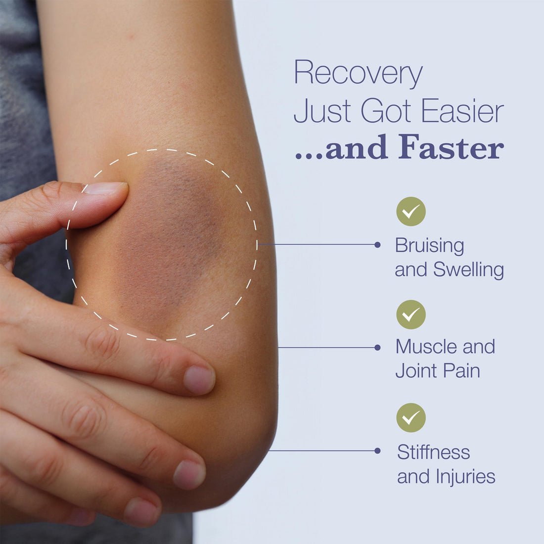 BruiseMD Arnica Bromelain Supplement for Bruises and Swelling (Capsules) - Doctor Preferred Formulation