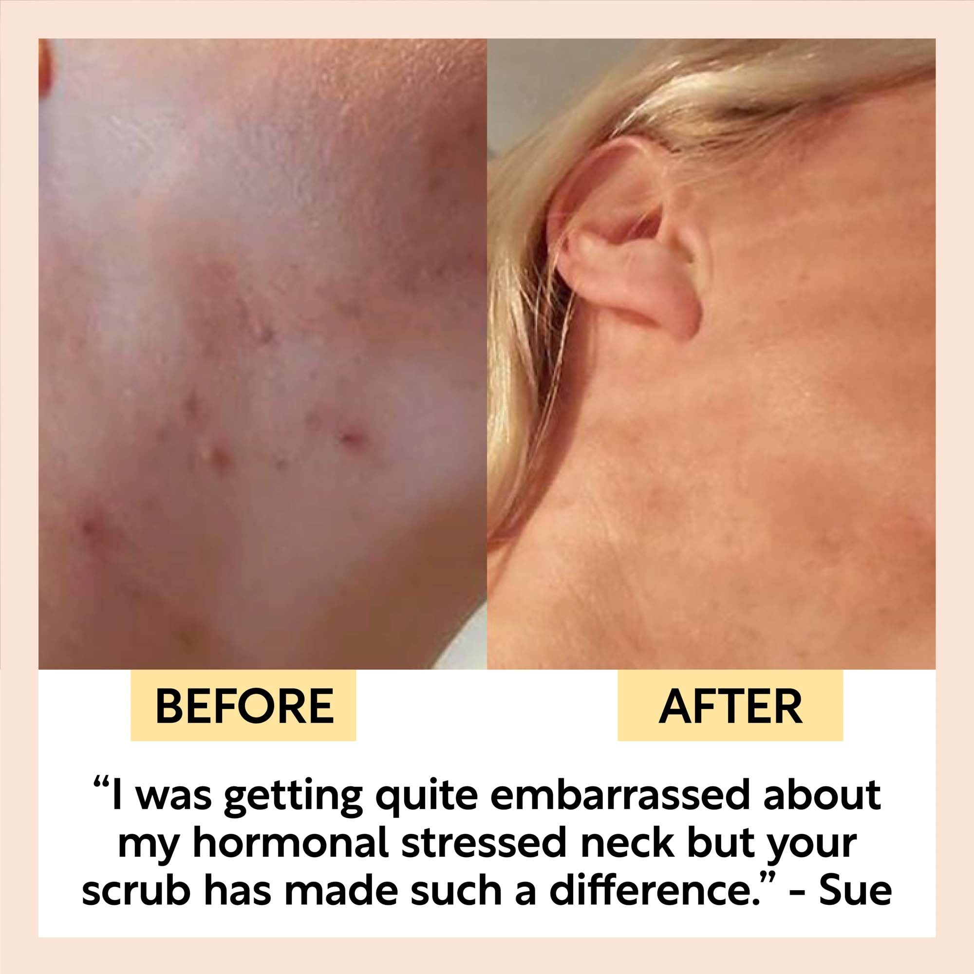 Natural Face Scrub – Citrus Blend for Dry Skin